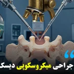 جراحی میکروسکوپی دیسک کمر در تهران