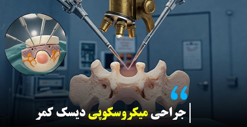 جراحی میکروسکوپی دیسک کمر در تهران