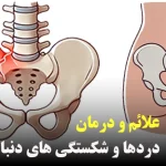 علائم درمان دردها و شکستگی های دنبالچه