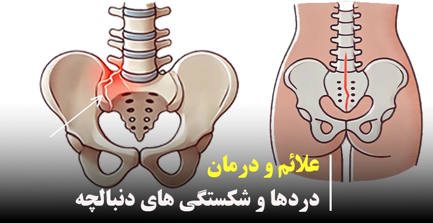 علائم درمان دردها و شکستگی های دنبالچه