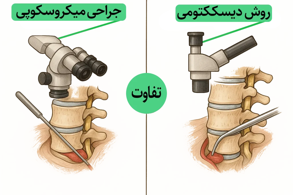 عمل میکروسکوپی دیسک کمر یا دیسککتومی