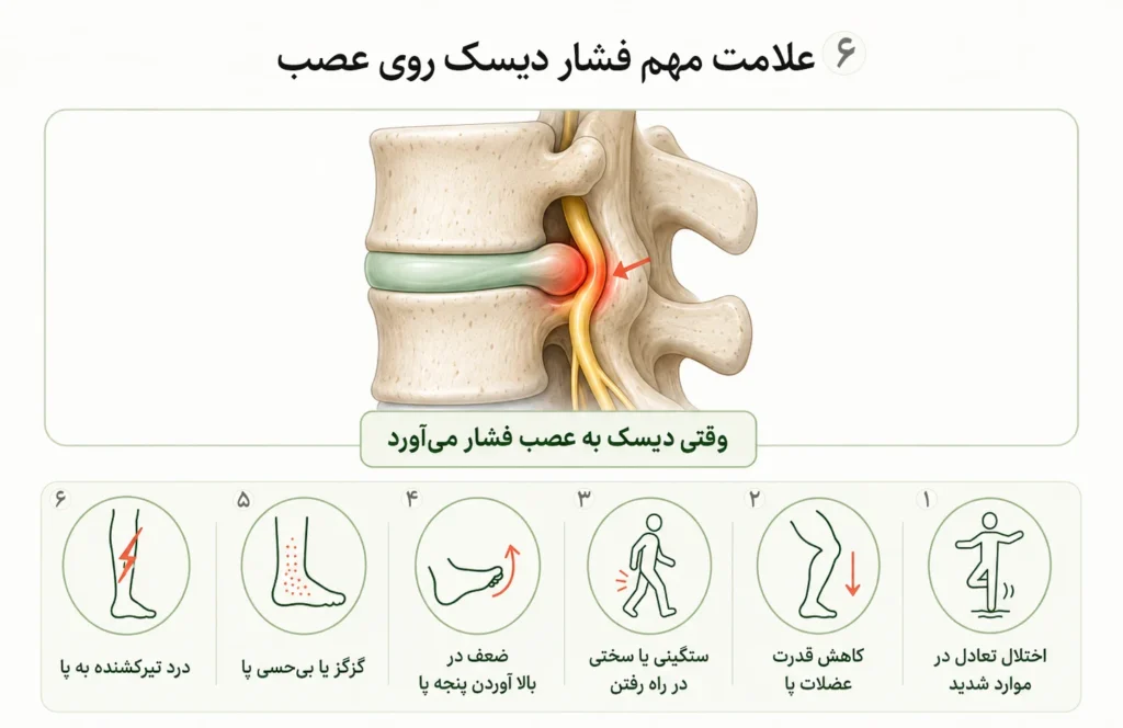 6علامت مهم فشار دیسک روی عصب
