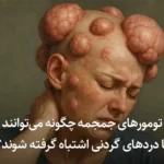 تومور جمجمه را با دیسک گردن اشتباه نگیرید !