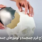 اصلاح فرم جمجمه و تومورهای جمجمه