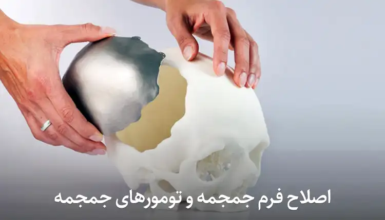 اصلاح فرم جمجمه و تومورهای جمجمه
