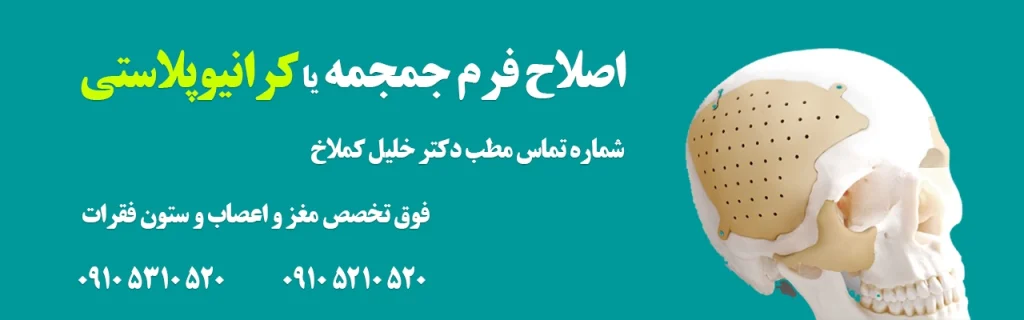 اصلاح فرم جمجمه و تومورهای جمجمه 1 اصلاح فرم جمجمه یا کرانیوپلاستی