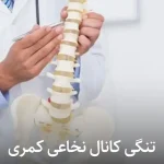 درمان تنگی کانال نخاعی در تهران