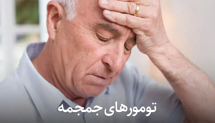 تومورهای جمجمه