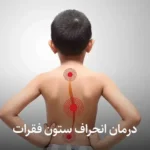 درمان انحراف ستون فقرات در تهران