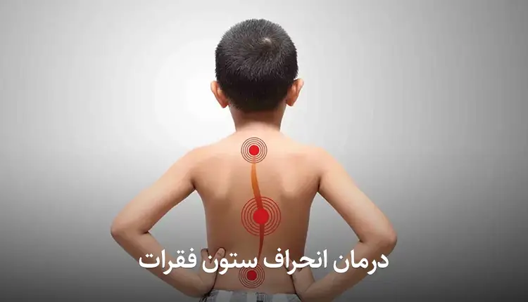 درمان انحراف ستون فقرات
