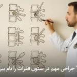 7 جراحی مهم در ستون فقرات را نام ببر؟