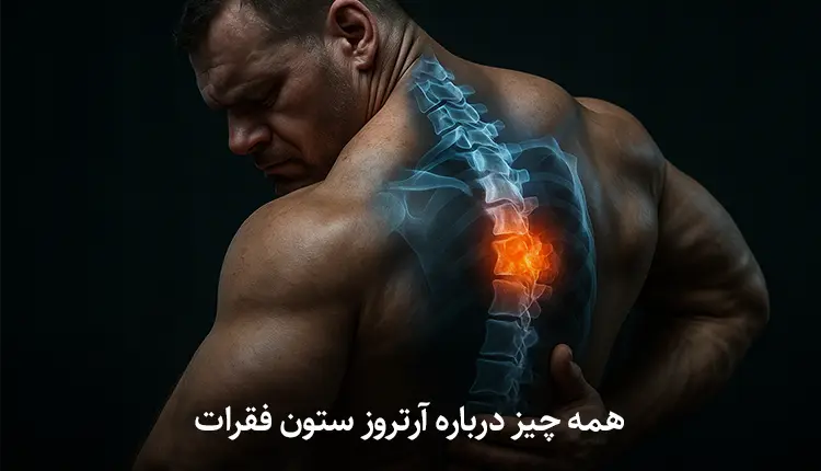 آرتروز ستون فقرات