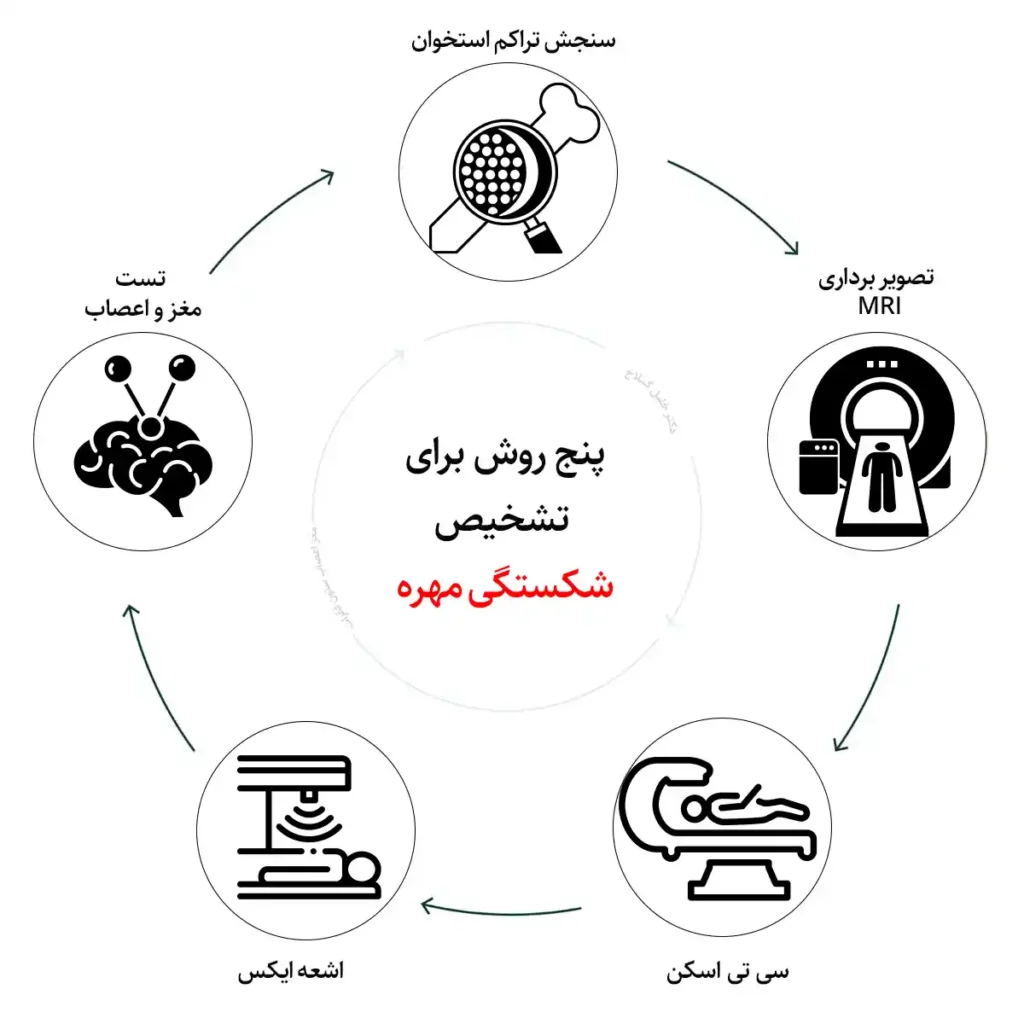 چگونگی تشخیص شکستگی در مهره‌های کمر