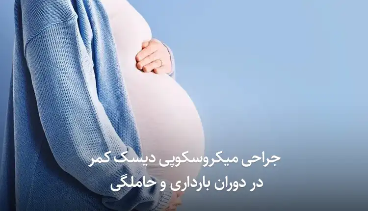 جراحی میکروسکوپی دیسک کمر در دوران بارداری و حاملگی