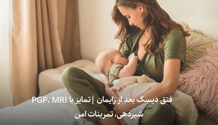 فتق دیسک بعد از زایمان | تمایز با PGP، MRI شیردهی، تمرینات امن