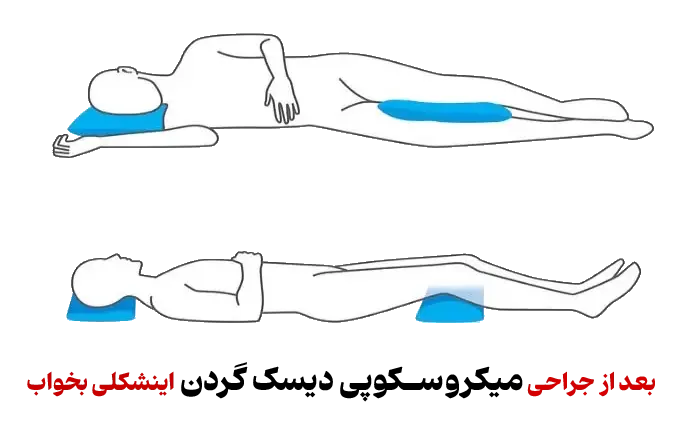 بهترین حالت خوابیدن و استراحت بعد از میکروسکوپیک دیسک گردن copy