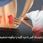 تفاوت دردِ دیسک کمر با درد کلیه را چگونه تشخیص دهیم؟