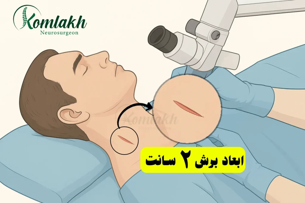 جراحی دیسک گردن از راه گلو میسر می باشد