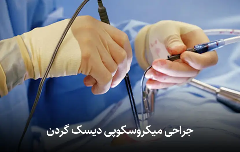 جراحی میکروسکوپی دیسک گردن: هزینه، مراحل، عوارض و درصد موفقیت