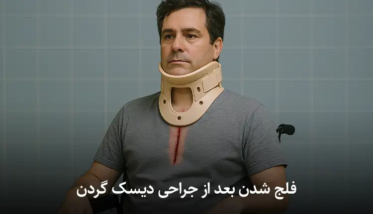 فلج شدن با دیسک گردن